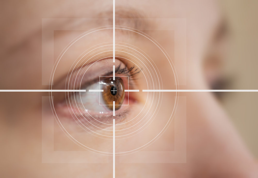 FAQ About LASIK Procedure Image