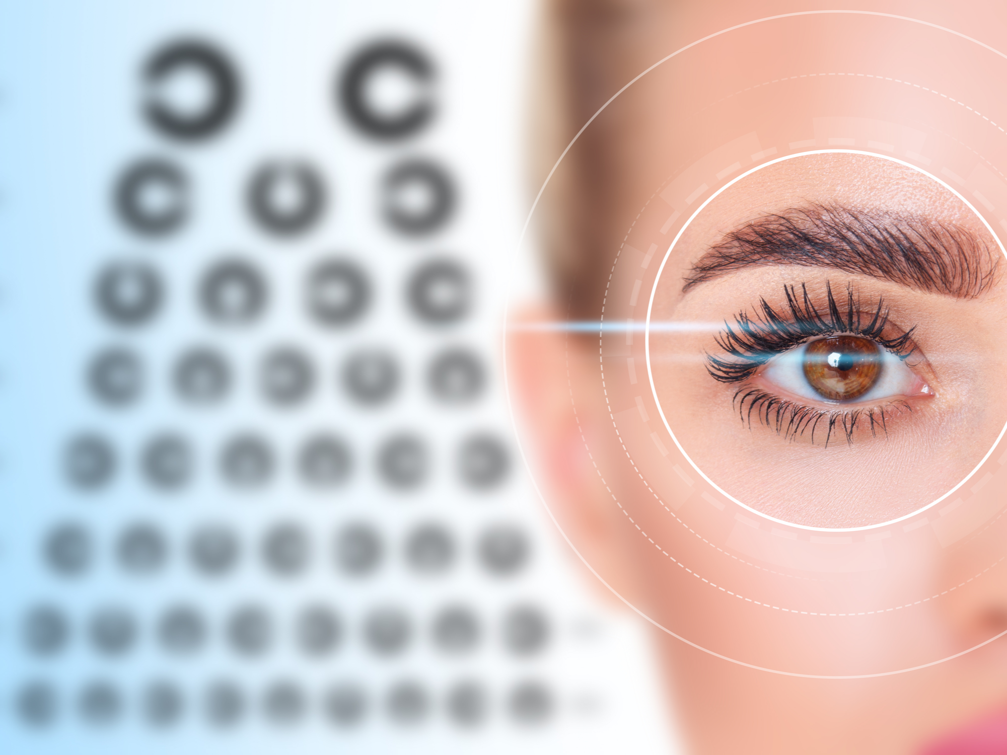 LASIK Surgery Recovery and Aftercare Image