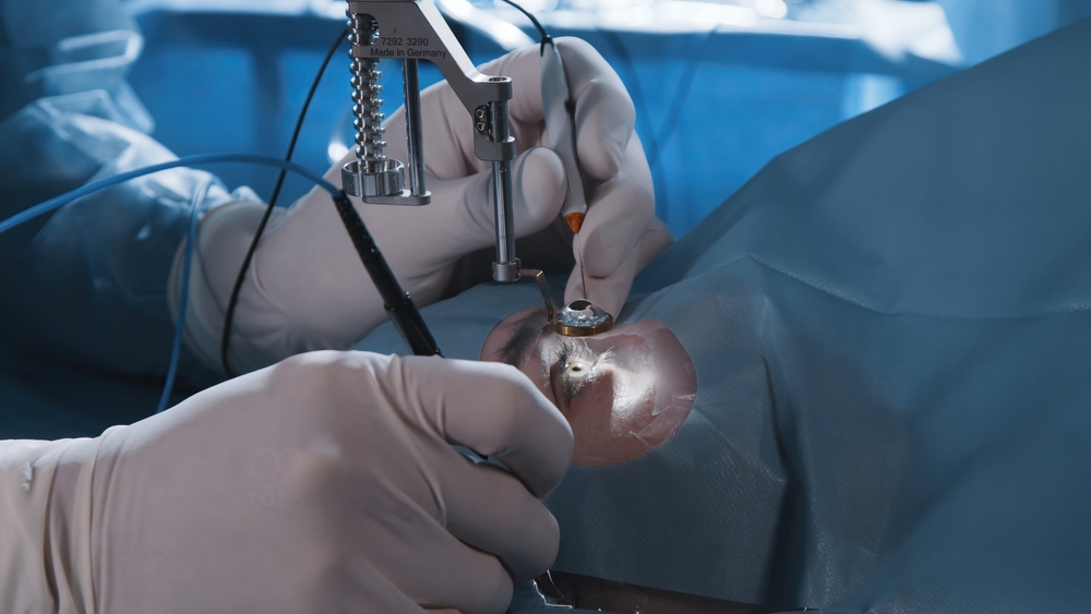 The Latest Advances in Cataract Surgery: What Patients Need to Know Image