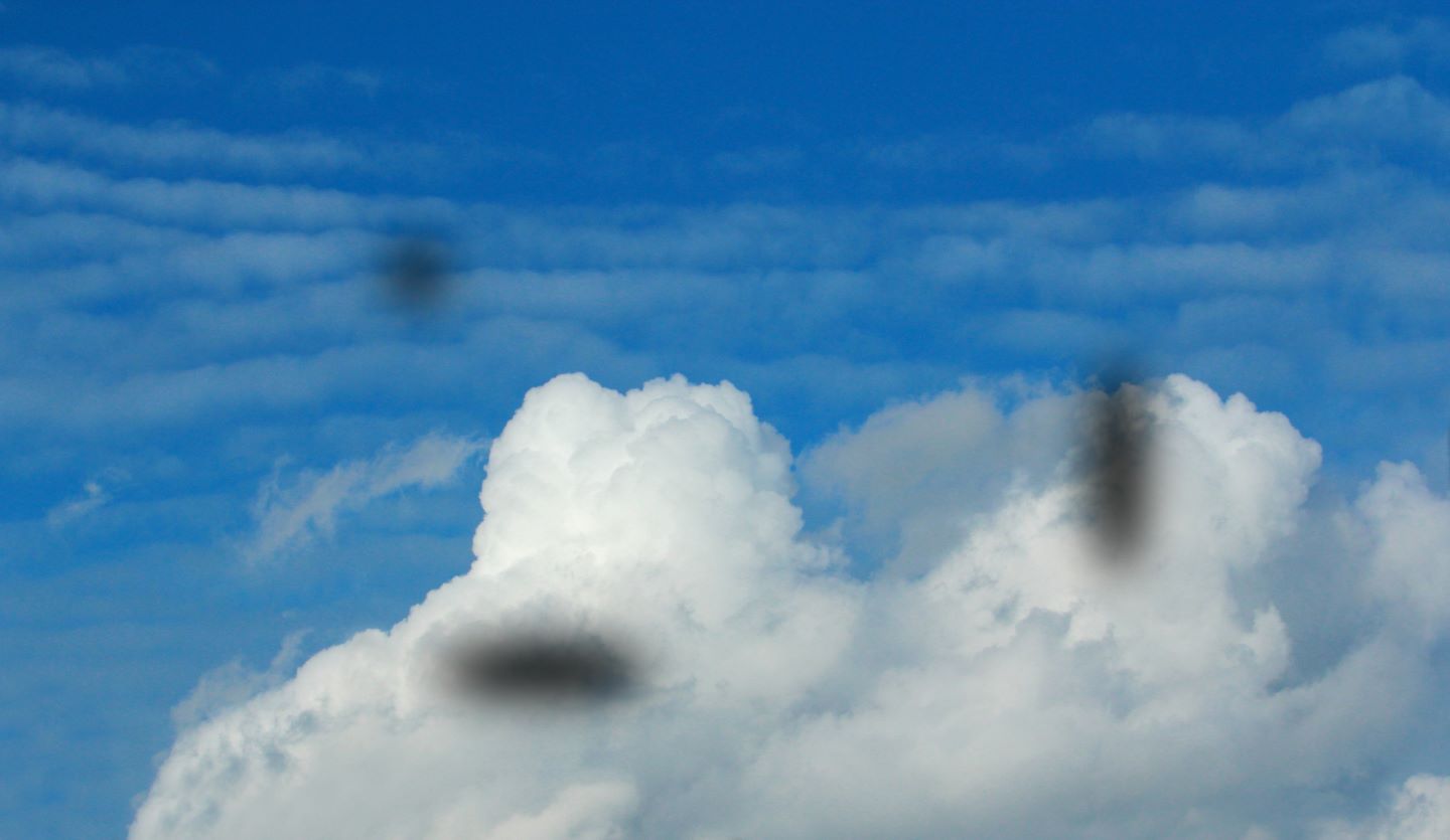 Eye Floaters and Flashes: When Should You Be Concerned? Image